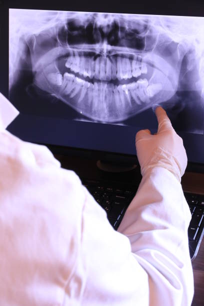 Best Emergency TMJ Treatment in Cottleville, MO