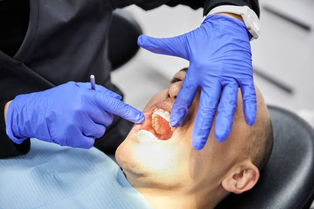 Best Emergency Tooth Extraction in Cottleville, MO